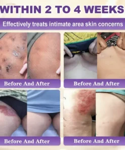 Owiwell® Biotin 10-in-1 Skin Restoration Cream