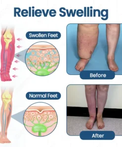 Owiwell® Roll-On Cream for Lymphatic Drainage & Swelling Relief