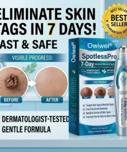 Owiwell® SpotlessPro Advanced Skin Care Pen