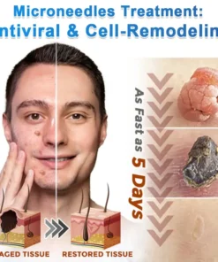 OWIWELL® 2-in-1 Microneedle & Hydrocolloid Patch