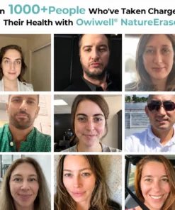 Owiwell® NatureErase Instant Alligator Oil Mole & Spot Removal Gel