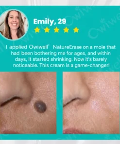 Owiwell® NatureErase Instant Alligator Oil Mole & Spot Removal Gel