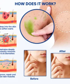 Owiwell® NatureErase Instant Alligator Oil Mole & Spot Removal Gel
